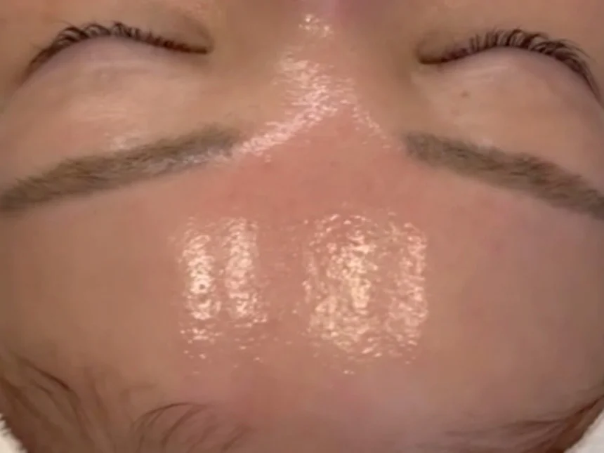 水分量アップ 施術後